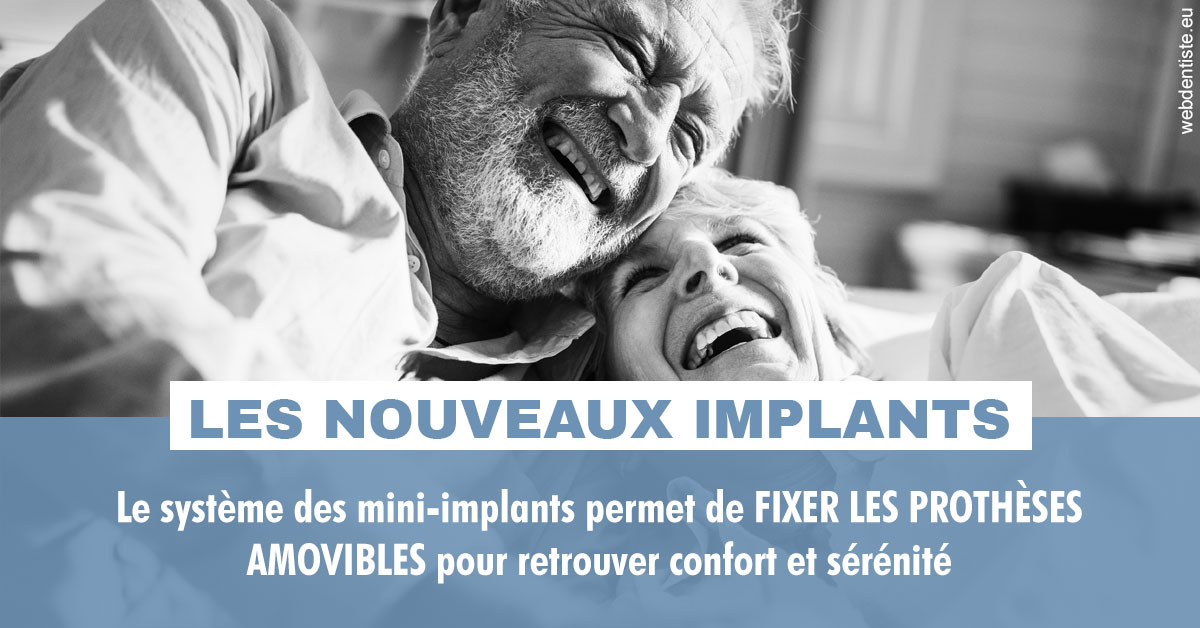 https://dr-vincent-dorothee.chirurgiens-dentistes.fr/Les nouveaux implants 2