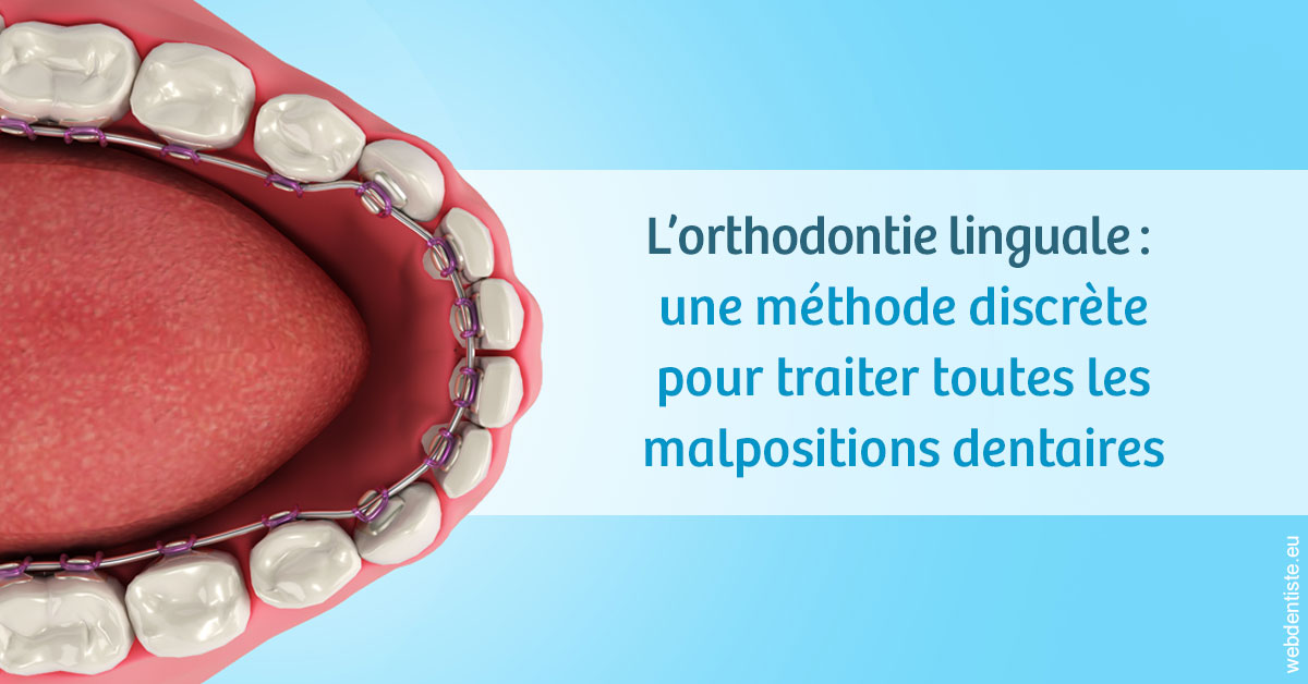https://dr-vincent-dorothee.chirurgiens-dentistes.fr/L'orthodontie linguale 1