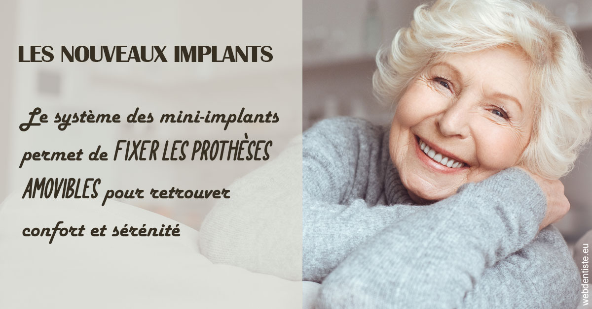 https://dr-vincent-dorothee.chirurgiens-dentistes.fr/Les nouveaux implants 1