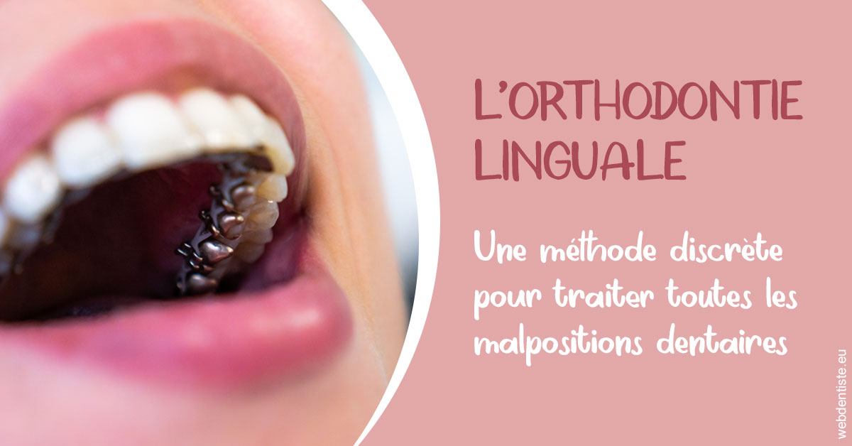 https://dr-vincent-dorothee.chirurgiens-dentistes.fr/L'orthodontie linguale 2