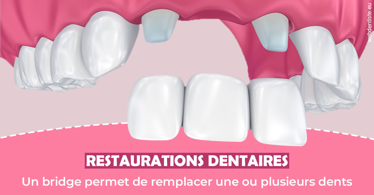 https://dr-vincent-dorothee.chirurgiens-dentistes.fr/Bridge remplacer dents 2