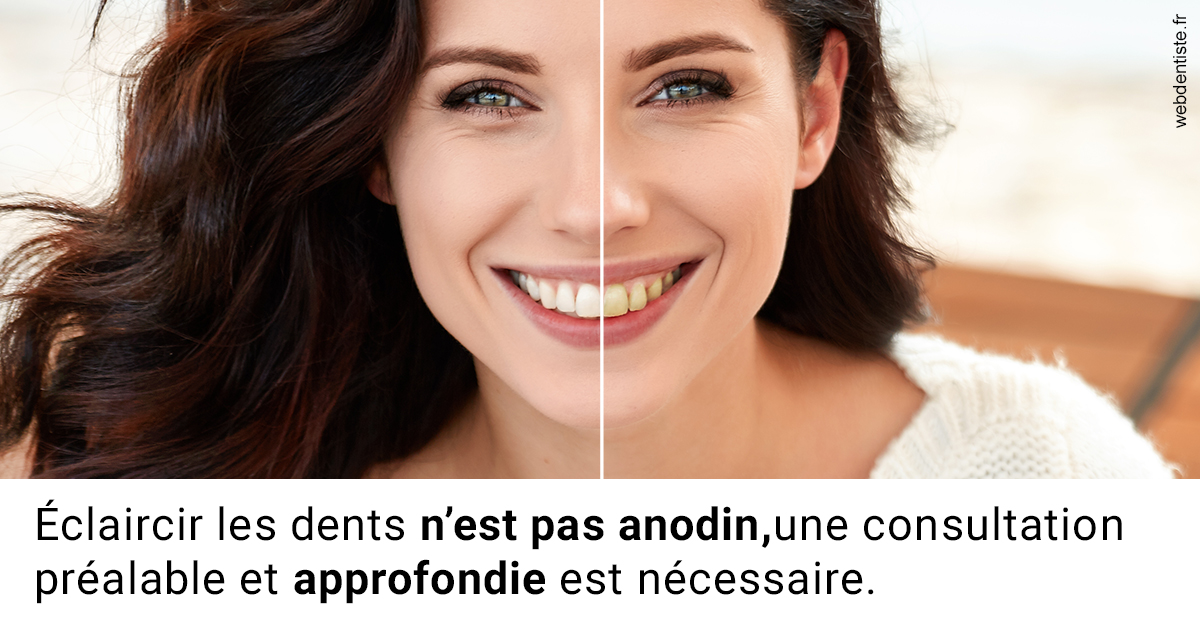 https://dr-vincent-dorothee.chirurgiens-dentistes.fr/Le blanchiment 2