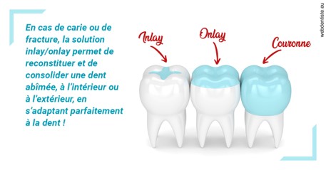 https://dr-vincent-dorothee.chirurgiens-dentistes.fr/L'INLAY ou l'ONLAY