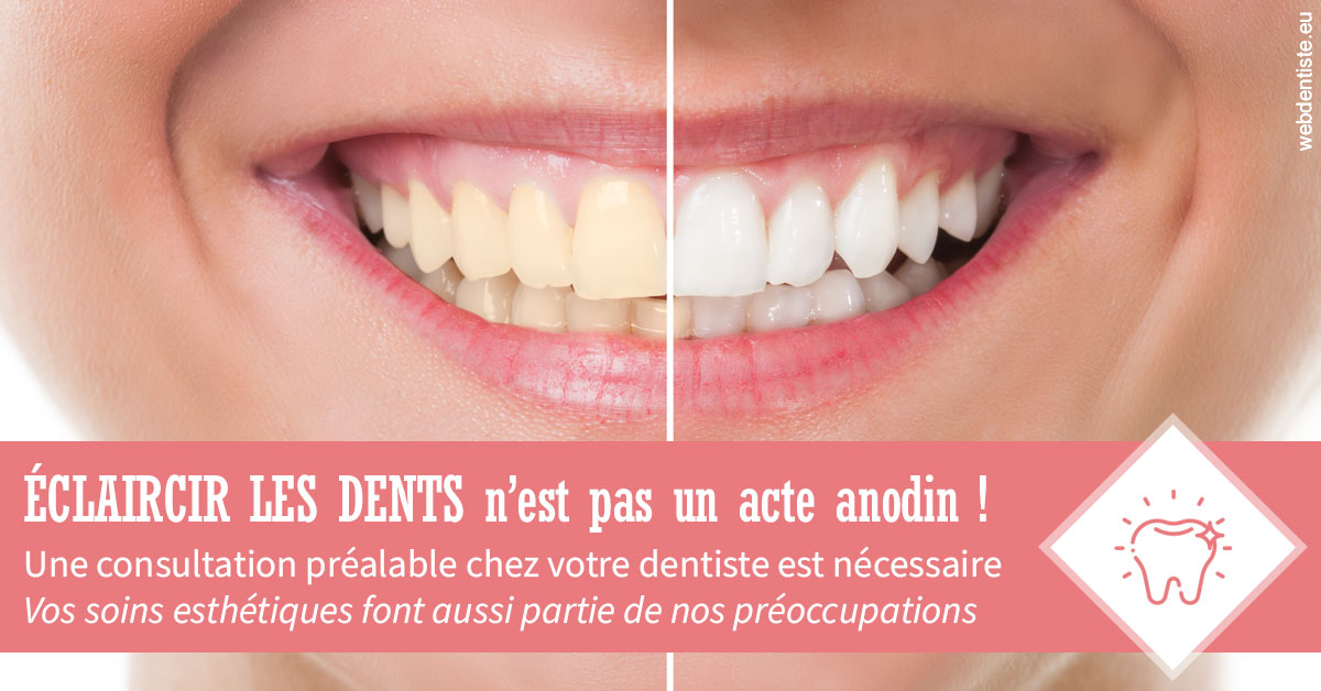 https://dr-vincent-dorothee.chirurgiens-dentistes.fr/Eclaircir les dents 1