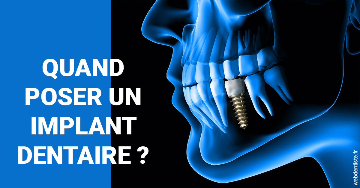 https://dr-vincent-dorothee.chirurgiens-dentistes.fr/Les implants 1