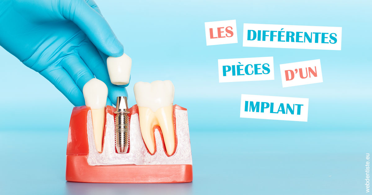 https://dr-vincent-dorothee.chirurgiens-dentistes.fr/Les différentes pièces d’un implant 2