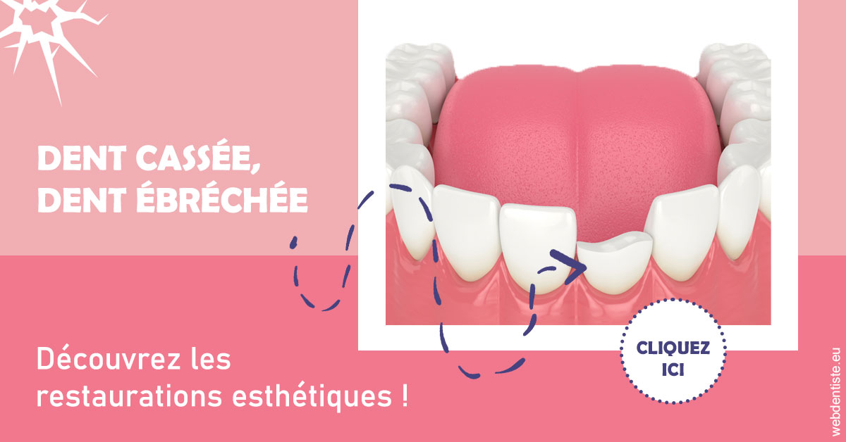 https://dr-vincent-dorothee.chirurgiens-dentistes.fr/Dent cassée ébréchée 1