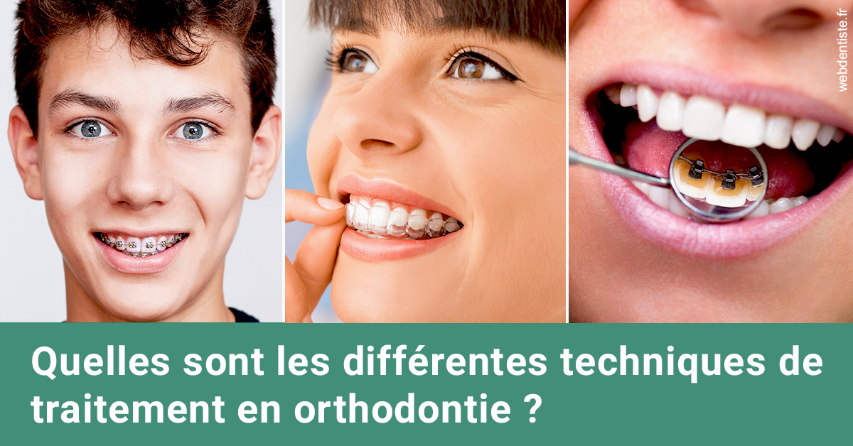 https://dr-vincent-dorothee.chirurgiens-dentistes.fr/Les différentes techniques de traitement 2