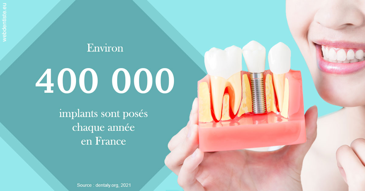 https://dr-vincent-dorothee.chirurgiens-dentistes.fr/Pose d'implants en France 2