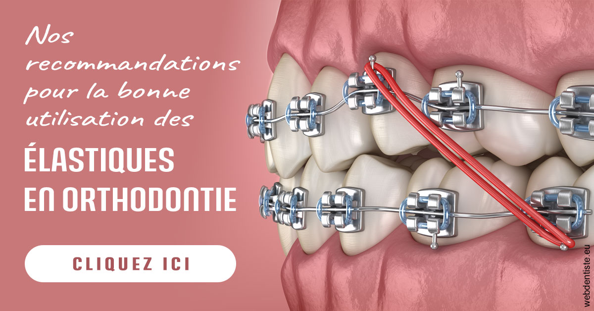 https://dr-vincent-dorothee.chirurgiens-dentistes.fr/Elastiques orthodontie 2